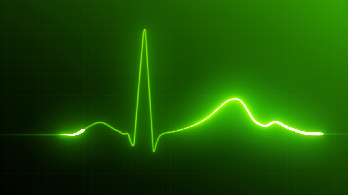 What is Heart Rate Variability and what does it mean